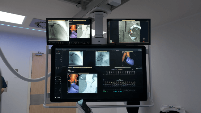 Nueva sala de hemodinamia, Tecnolog�a exclusiva